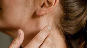 Muncul Benjolan di Leher Bawah Dagu? Ini Penyebab Kelenjar Getah Bening Bengkak yang Perlu Diwaspadai