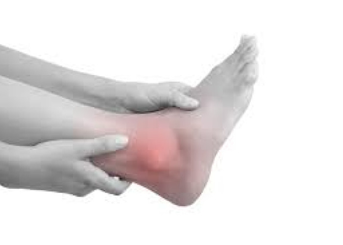 5 Kebiasaan Sepele Pemicu Asam Urat dan Kolesterol Tinggi di Usia Muda, Nomor 3 Paling Sering Dilakukan