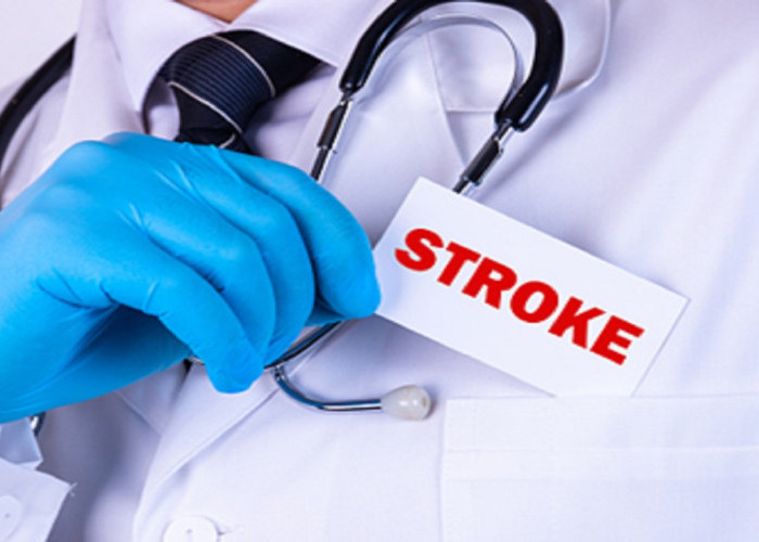 Waspada Stroke di Usia Muda: 5 Tanda Awal yang Sering Diabaikan, Bisa Terjadi di Bawah 35 Tahun!