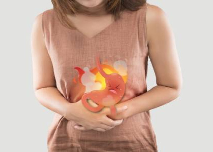 Asam Lambung Sering Naik? Ini 7 Penyebab yang Wajib Diwaspadai agar Tidak Kambuh