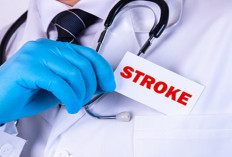 Waspada Stroke di Usia Muda: 5 Tanda Awal yang Sering Diabaikan, Bisa Terjadi di Bawah 35 Tahun!