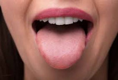 4 Tanda Diabetes Bisa Terlihat dari Kondisi Lidah, Jangan Diabaikan! Ini Penjelasan Lengkapnya